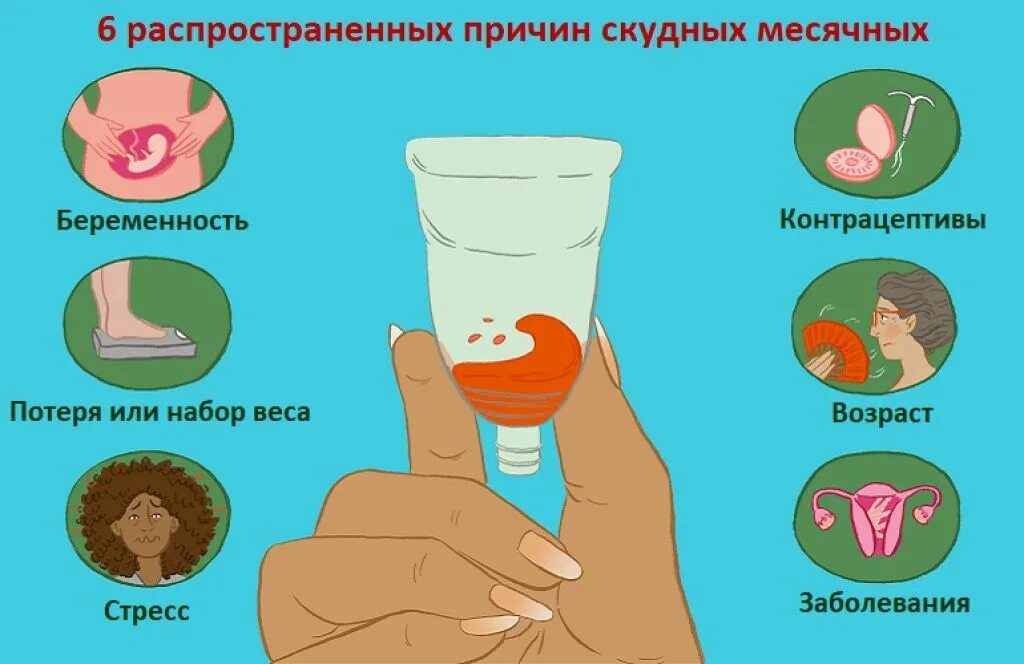 скудные месячные причины. обильность менструации. объем кровопотери при менструации. первые месячные у девочек сколько дней идут. скудные и нормальные месячные.