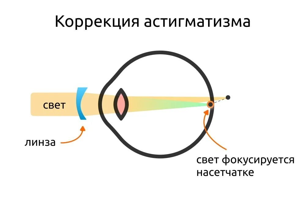 Физ око. Эмметропия рефракция. Рефракция глаза. Исследование рефракции глаза. Физическая рефракция глаза.