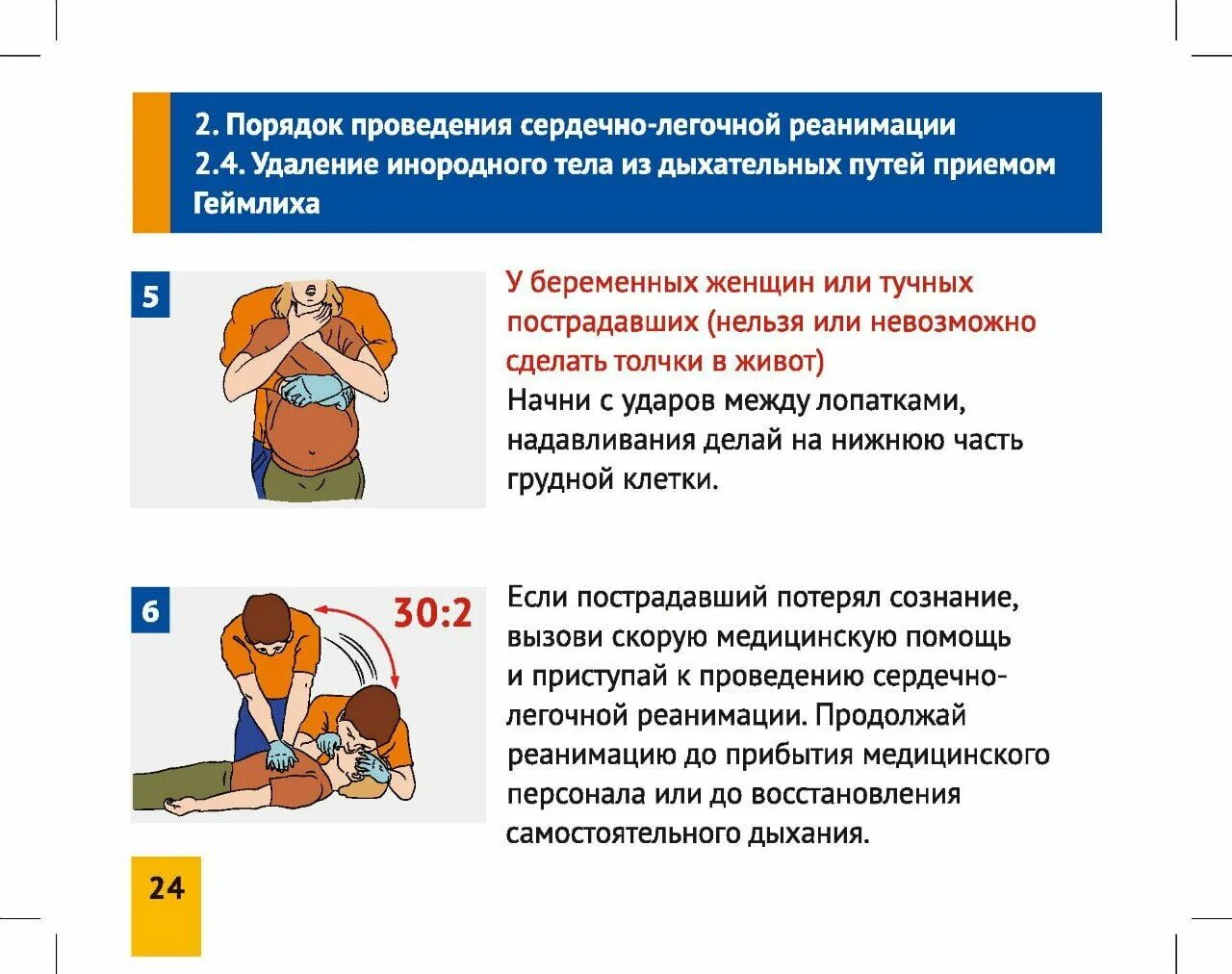 Какую первую помощь нужно. Сердечно-легочная реанимация прием геймлиха. экстренная помощь при попадании инородного тела в дыхательные пути. порядок действий при оказании неотложной помощи.. попадание инородного тела в дыхательные пути.