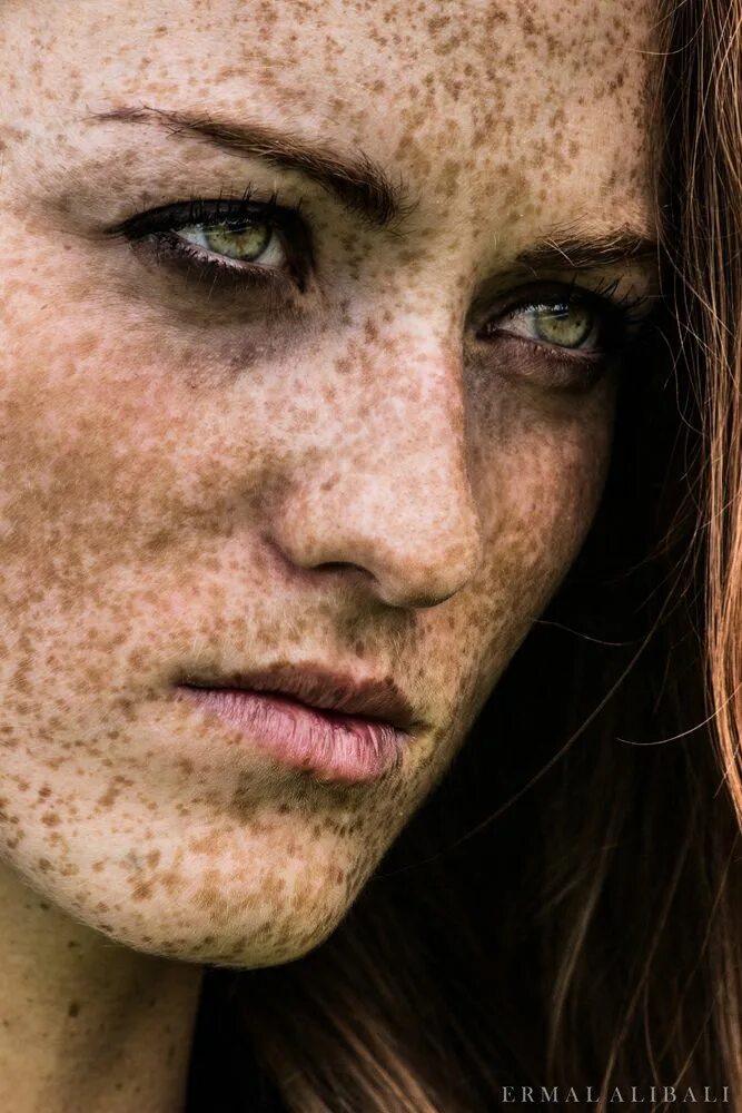 девушка с веснушками. веснушки на английском. веснушки на английском. витилиго гиперпигментация. джиллиан басерсон веснушки.