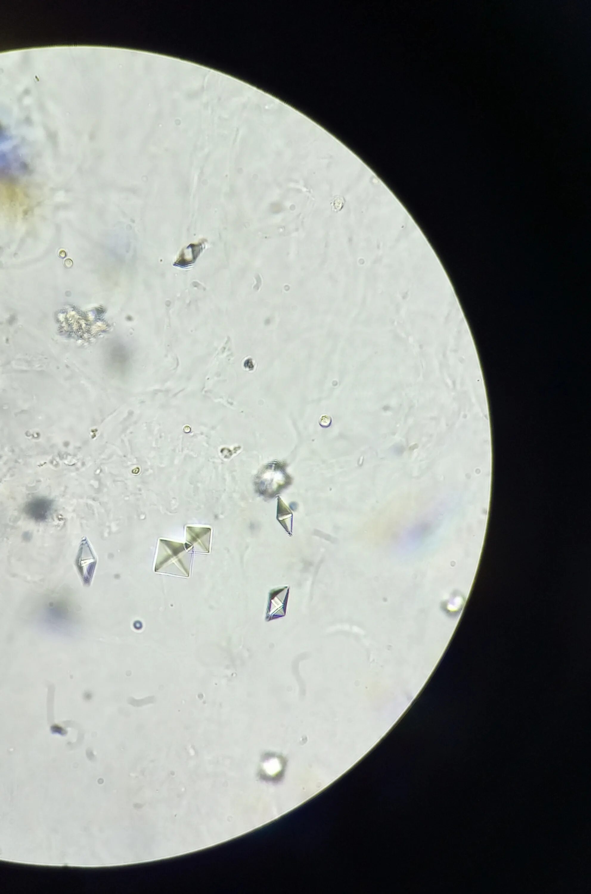 Кристаллы оксалата кальция микроскопия. Оксалаты микроскопия мочи. Фосфорнокислый кальций в моче микроскопия. Оксалат кальция под микроскопом. Кристаллы оксалата в моче у мужчин