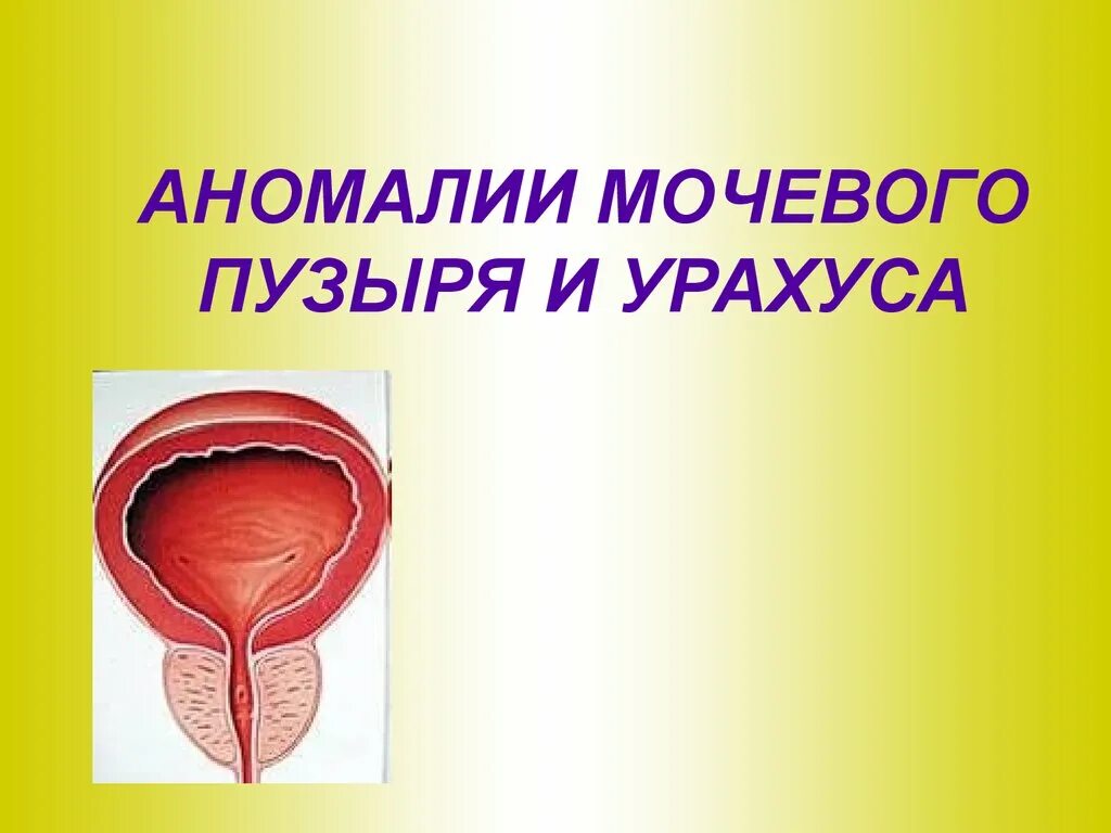 Аномалия мочевого. Аномалии мочевого пузыря. Аномалии урахуса мочевого.