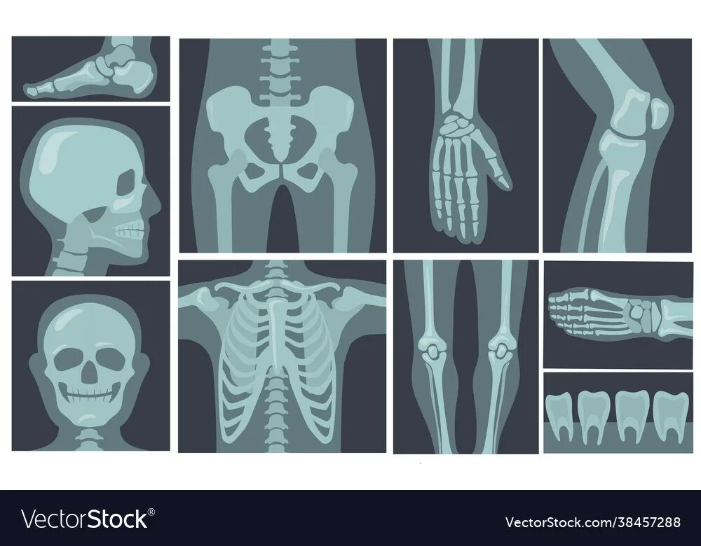 Рентген вектор. Human hand Skeleton XRAY. Снимок рентген клипарт. Рентген снимок рамка вектор. Bones ray