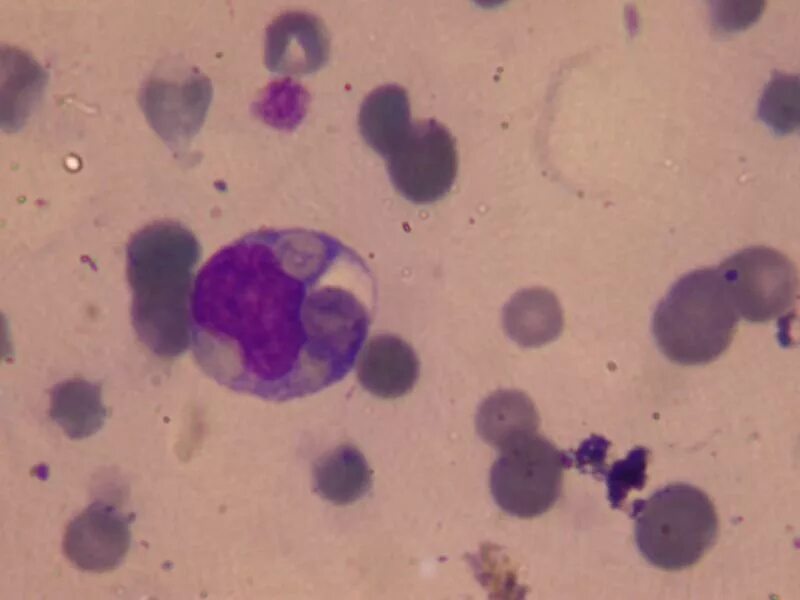 Chlamydia trachomatis mycoplasma genitalium. Микоплазма пневмония микроскопия. Микоплазма окраска по Романовскому-Гимзе. Микоплазмоз микроскопия.