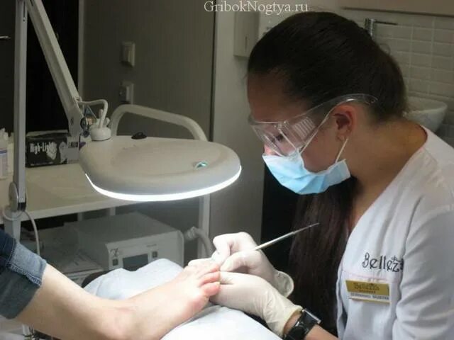 Резекция вросшего ногтя. Лазерная операция вросшего ногтя. Лазерная резекция вросшего ногтя. Вырезание вросшего ногтя лазером. Лазерная коррекция ногтя.