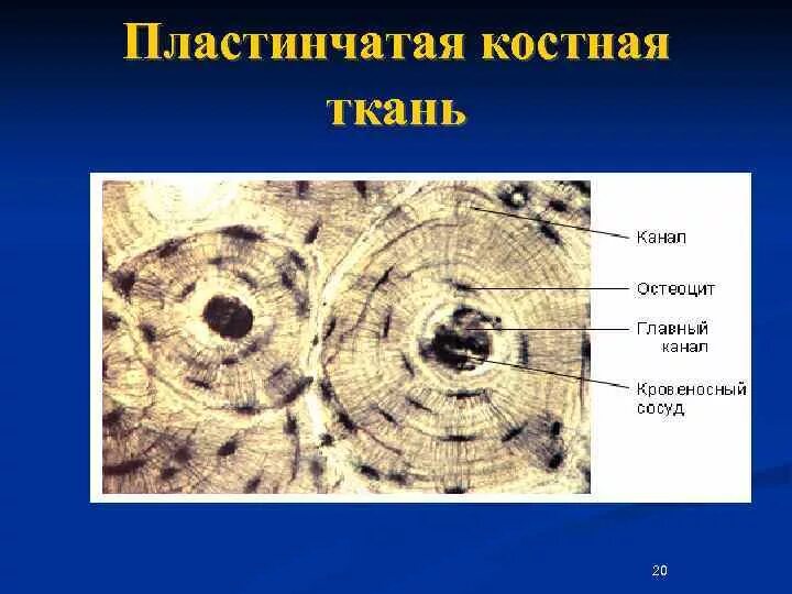 Тонковолокнистая пластинчатая костная ткань. Пластинчатая костная ткань Электронограмма. Пластинчатая костная ткань гистология. Пластинчатая костная ткань Остеон. Пластинчатая кость