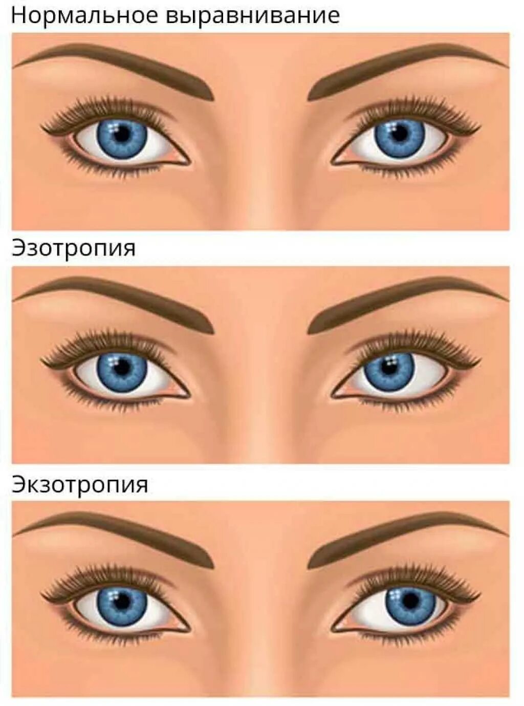 В глазах двоится и расплывается почему