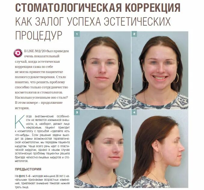 Можно ли исправить асимметрию
