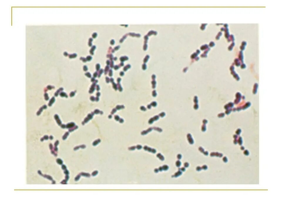 Peptostreptococcus. Пептострептококки микробиология. Вейлонеллы бактероиды фузобактерии. Анаэробные стрептококки пептострептококки. Пептококки нигер.