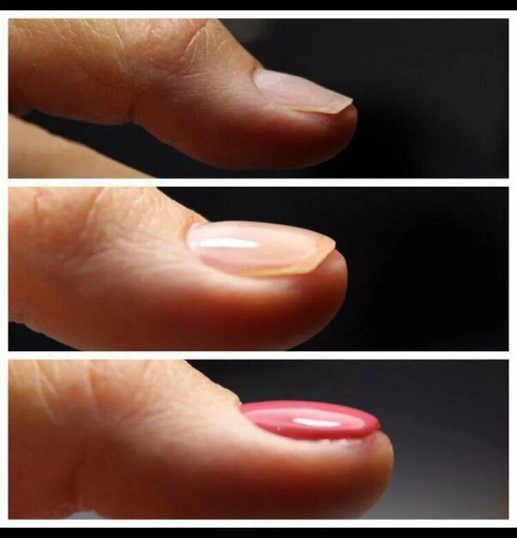 Ногти тонкие мягкие что делать. Выравнивание ногтевой пластины базой. Апекс ногтевой пластины. Выравнивание ногтевой пластины гелем. Ногти без выравнивания.