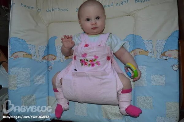 Электрофорез при дисплазии