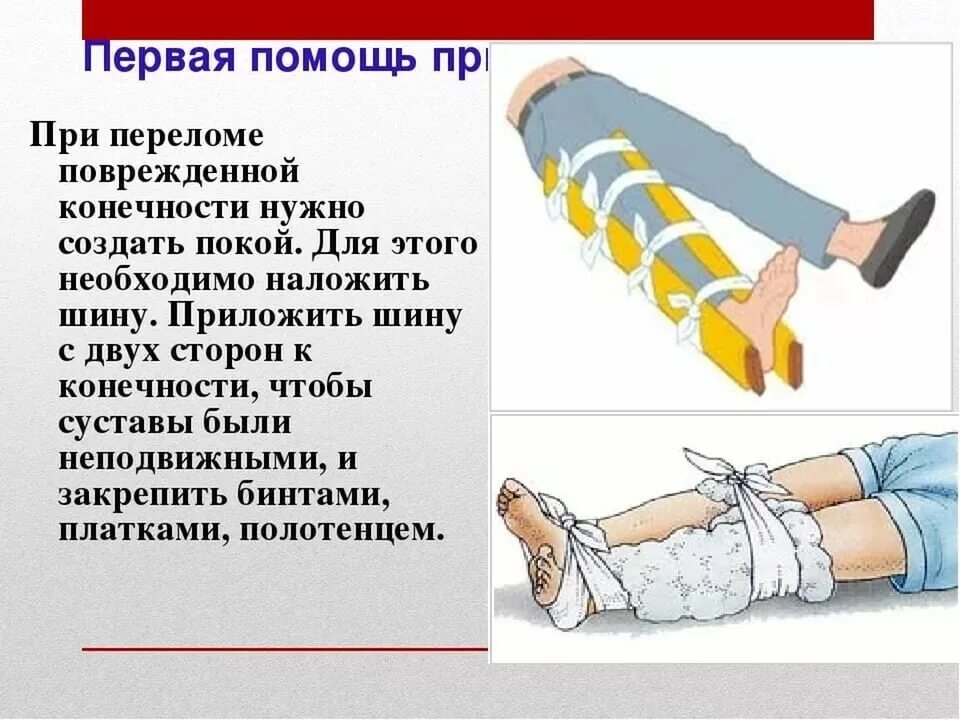 При открытом переломе следует. Оказание первой доврачебной помощи при переломах костей конечностей. Последовательность оказания первой помощи при переломах костей. Оказание первой помощи при признаках перелома конечностей. Порядок оказания доврачебной помощи при переломе конечностей.