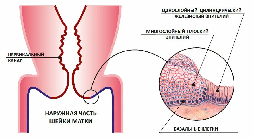 Шейка матки плоский эпителий и цилиндрический эпителий. Шейка матки зона трансформации. Дисплазия шеечного эпителия. Строение эпителия шейки матки. Цервикальный канал размеры