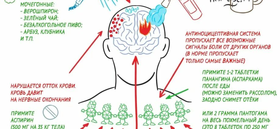 Как быстро снять головную боль без таблетки. Головная боль от похмелья. Болит голова при похмелье. Давит голову с похмелья. Сильная головная боль при похмелье.