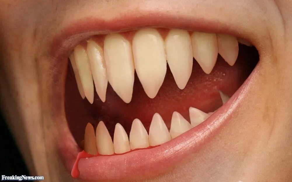 Pointed teeth. Pointed teeth