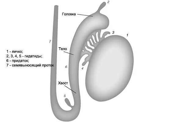 Гидатида Морганьи придаток яичка. Перекрут придатка гидатида яичка. Перекрут гидатида Морганьи. Заворот гидатиды Морганьи. Яички мужчин цена
