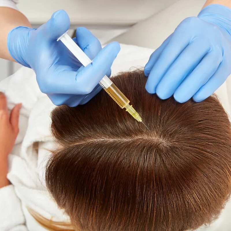 Инъекции головы. Мезо волосистой части головы. PRP плазмотерапия для волос. Плазмотерапия кожи головы. Плазмолифтинг волосистой части головы.