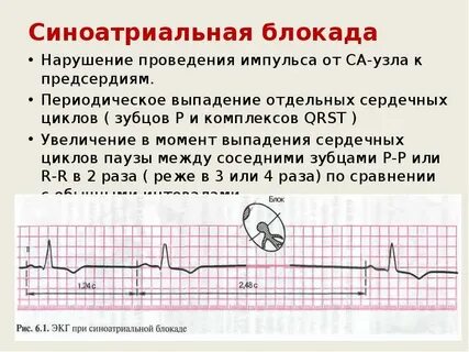 Блокада узла