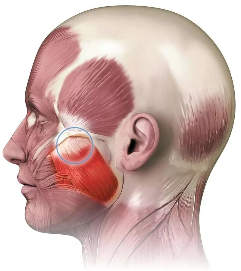 Спазм левой стороны. Мускулюс массетер. Гипертонус жевательных мыш. Жевательные мышцы. Челюстные мышцы.