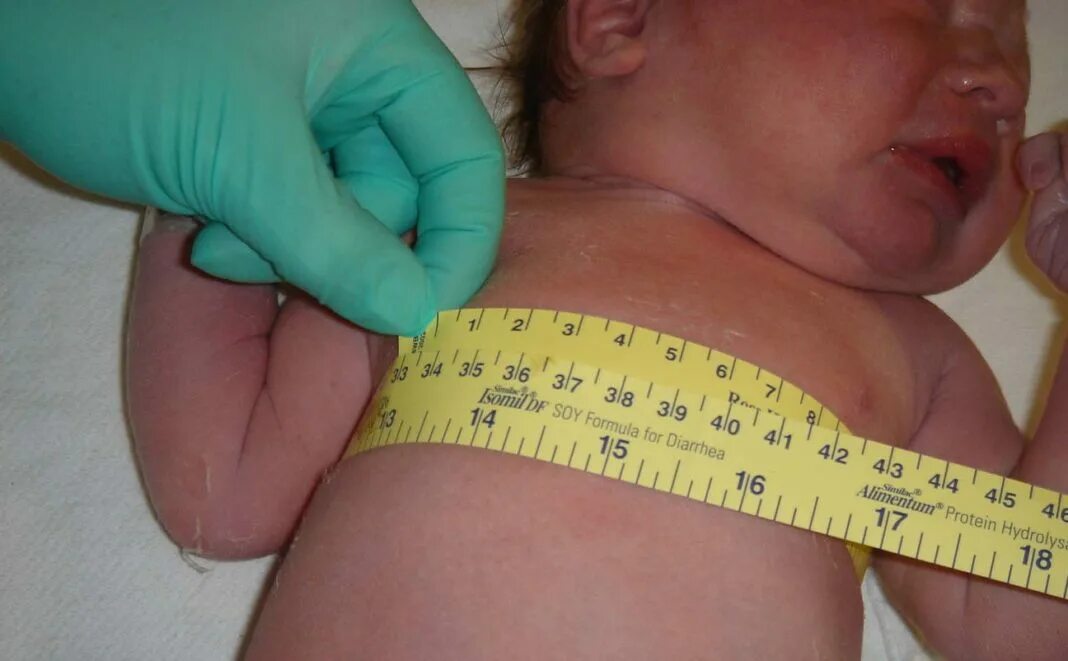 Грудная клетка ребенка 2 года. Измерение окружности грудной клетки у детей. Антропометрия измерение окружности грудной клетки. Измерение окружности грудной клетки грудного ребенка. Измерение окружности груди грудного ребенка.
