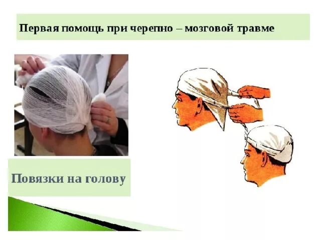 Помощь при черепно мозговой травме. Наложение повязки при черепно-мозговой травме. повязка на голову чмт. травма черепа первая помощь. пмп при травме волосистой части головы.