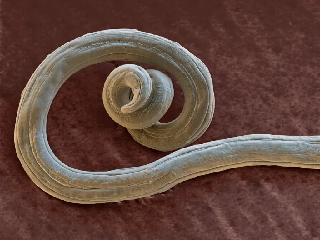 В какой среде обитает червь паразит. Черви паразиты Острица. Ленточные черви нематоды. Кошачьи паразиты анкилостомы.