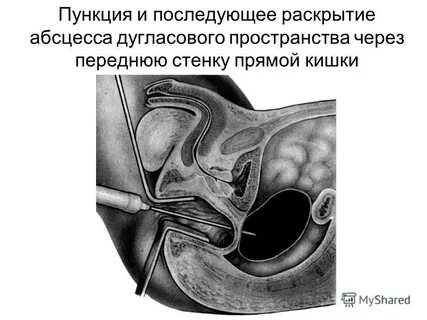 Дугласово пространство