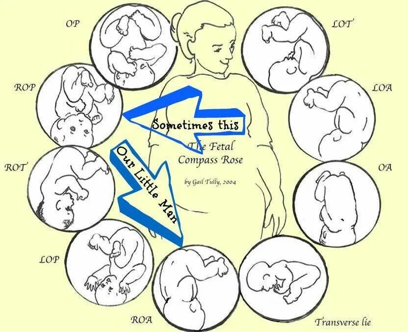 Положение плода в животе. Положение ребенка в животе. Положение ребёнка в живате. Как определить положение ребенка. Положение плода по шевелениям.