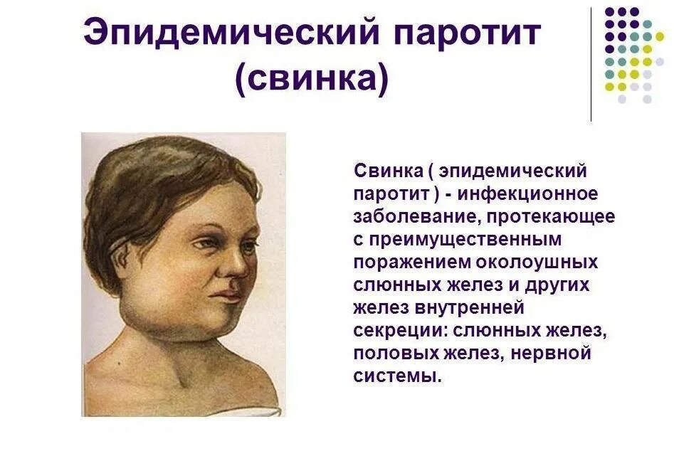 Эпидемический паротит возбудитель симптомы. Свинка эпидемический паротит детям. Эпидемический паротит. Свинка эпидемический паротит. Эпидпаротит у детей.