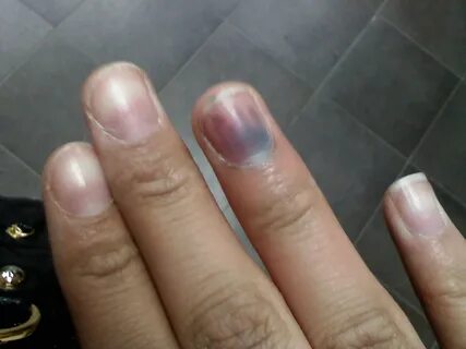 Как выглядит ногтевая пластина