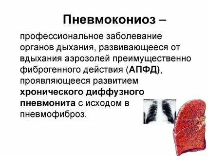 Пневмокониоз