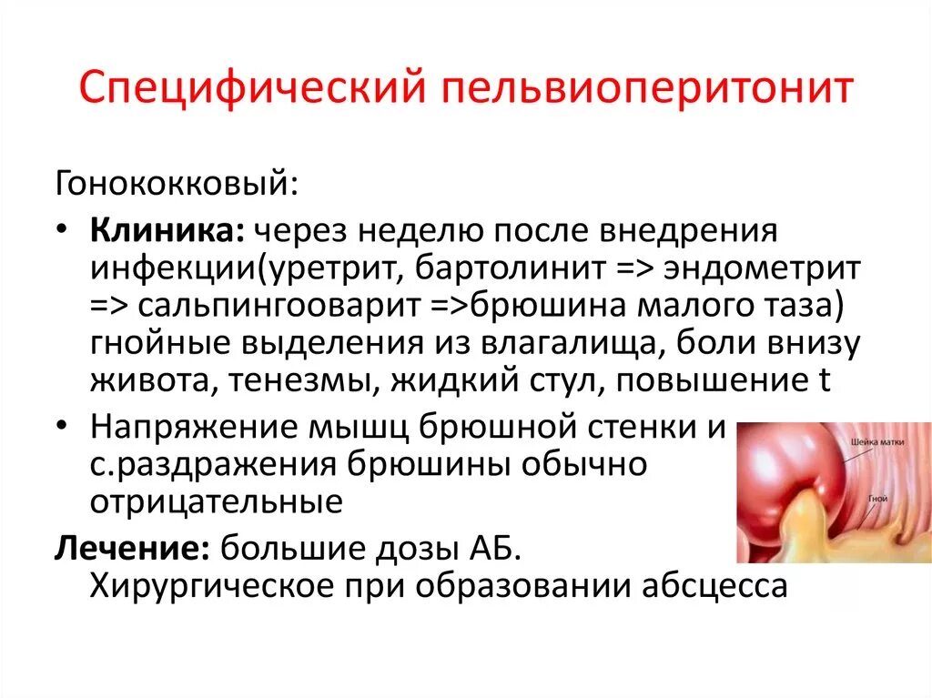 Почему часто воспаляется. Специфический пельвиоперитонит. Воспаление бартолиновой железы. Воспаление половых желез. Бартолиновая железа воспаление.