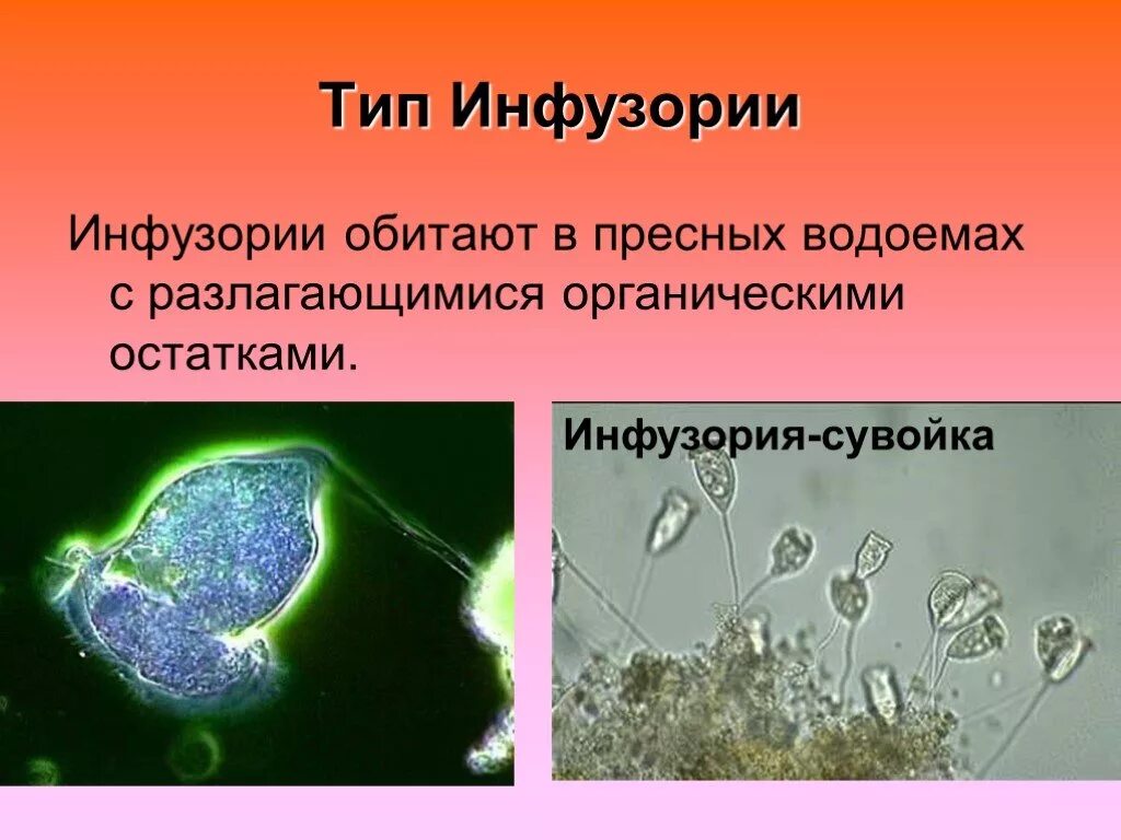 Строение сувойки. Кархезиум инфузория. Инфузория сувойка. Инфузории в пресном водоеме.