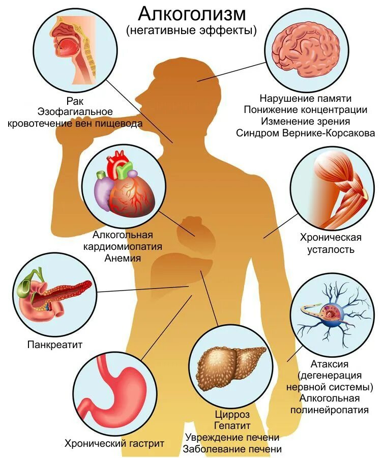 Заболевания вызванные алкоголем. Болезни вызванные алкоголем. Органы пораженные алкоголем. Поражение органов человека алкоголем.