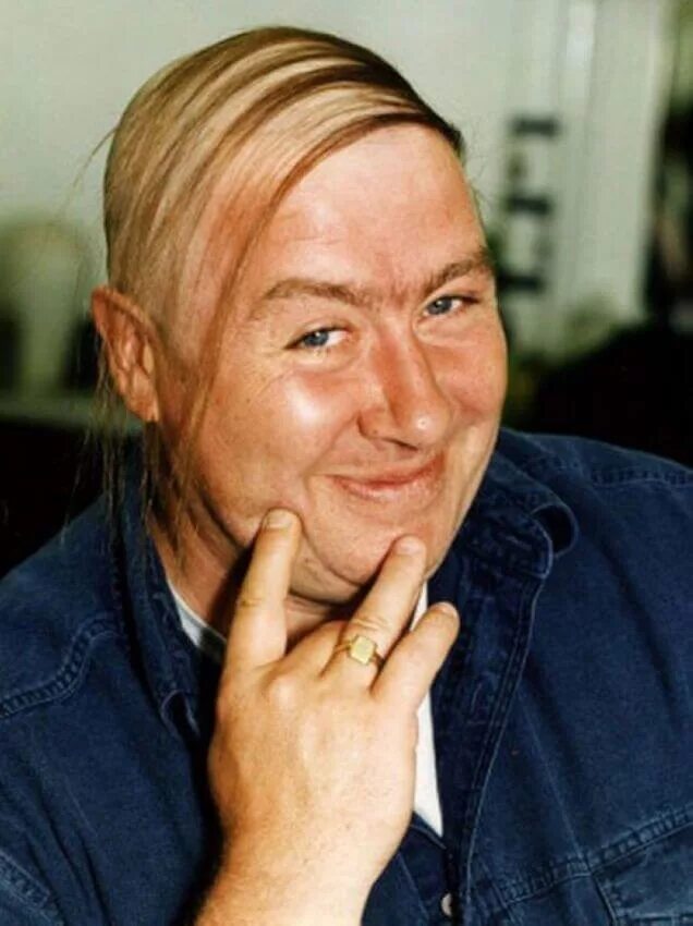 Как скрыть лысину. Зачесанная лысина. Прически с залысиной на макушке. Дональд трамп волосы лысина. Как скрыть лысину.