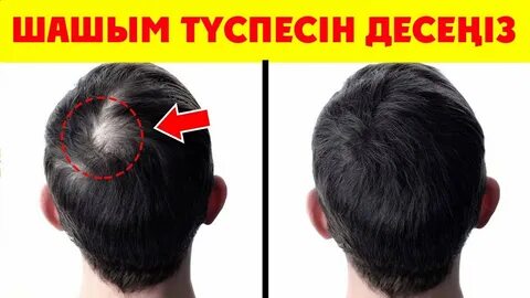 Шашты қара кистің фотосы