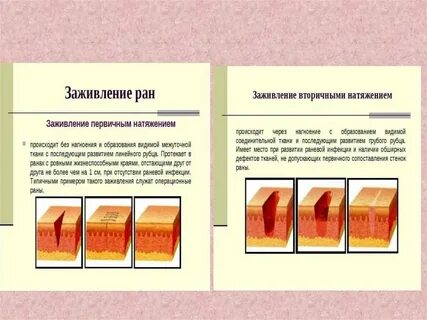 Сколько времени заживает рана
