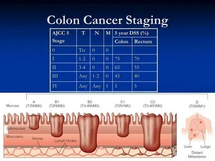 Cancer staging