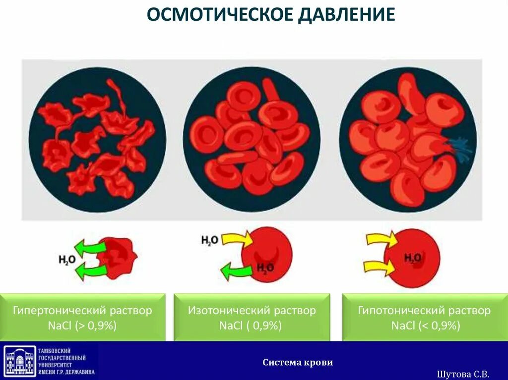 Осмотическое явление клеток крови. Осмотическое давление крови. Эритроциты в растворе хлорида натрия