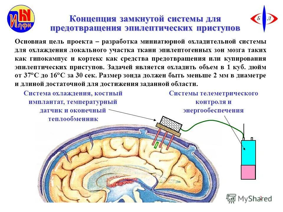 Закрытая замкнутая система