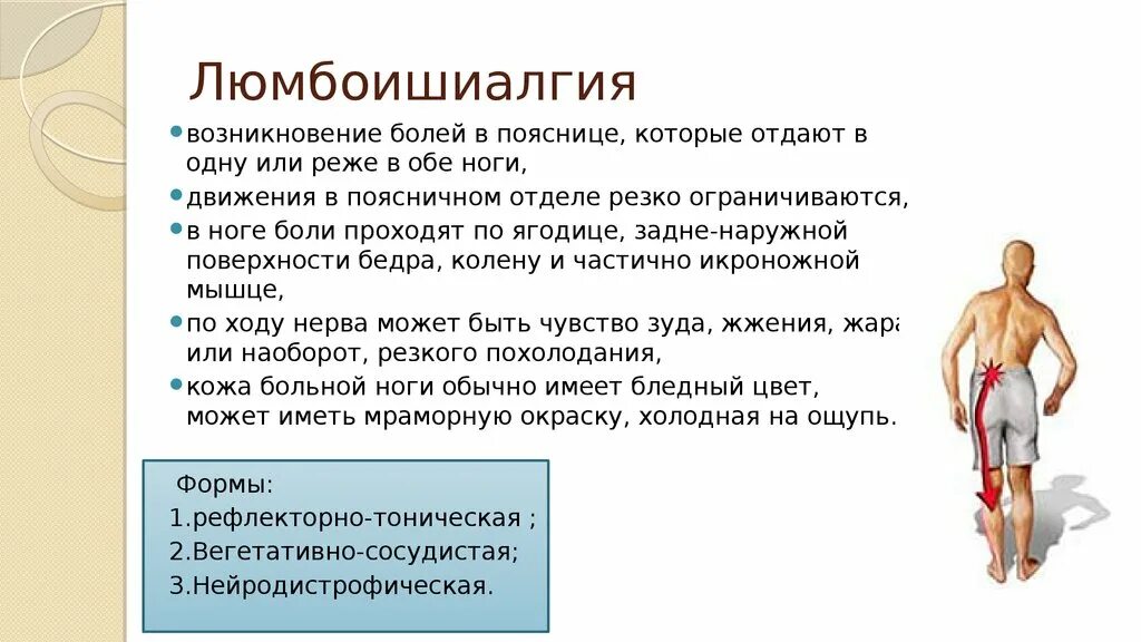 Острая боль в пояснице лечение. Боль в поясничной области. Люмбоишиалгия. Люмбоишиалгия поясничного. Люмбаго люмбалгия люмбоишиалгия.