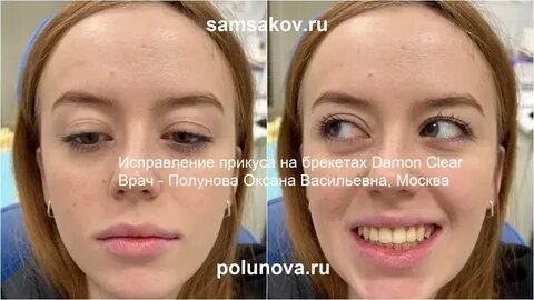 Неправильно отзывы
