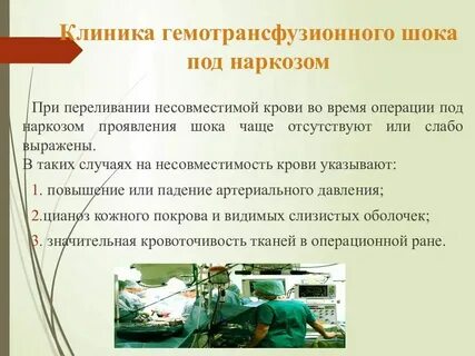 Время операции через второй