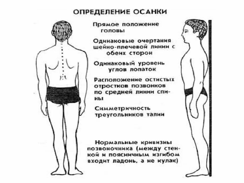 Осанку определяют как