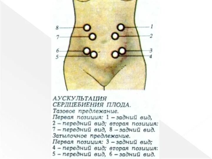 Пульсация на раннем сроке. Аускультация сердцебиения плода алгоритм. Точки наилучшего выслушивания сердцебиения плода. Выслушивание сердцебиения плода при 1 позиции. Выслушивание сердцебиения плода таблица.