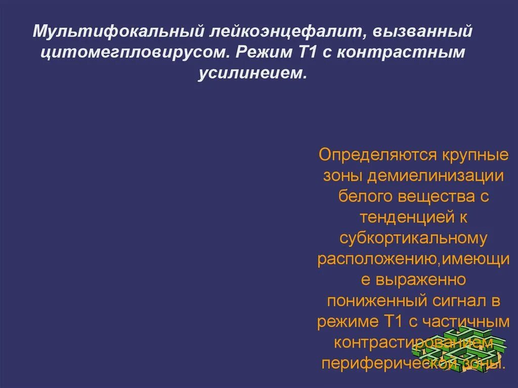 Лейкоэнцефалит. Лейкоэнцефалиты неврология. лейкоэнцефалит шильдера. энцефалит шильдера. лейкоэнцефалиты клиника.