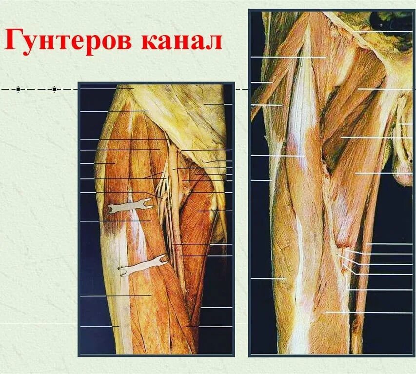 Гунтеров канал топографическая анатомия. Бедренно-подколенный канал топографическая анатомия. Бедренно подколенный канал Гунтера. Бедренно-подколенный приводящий канал.