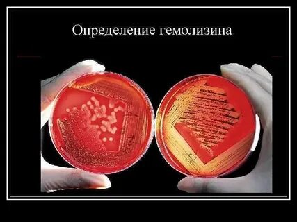 Гемолизин