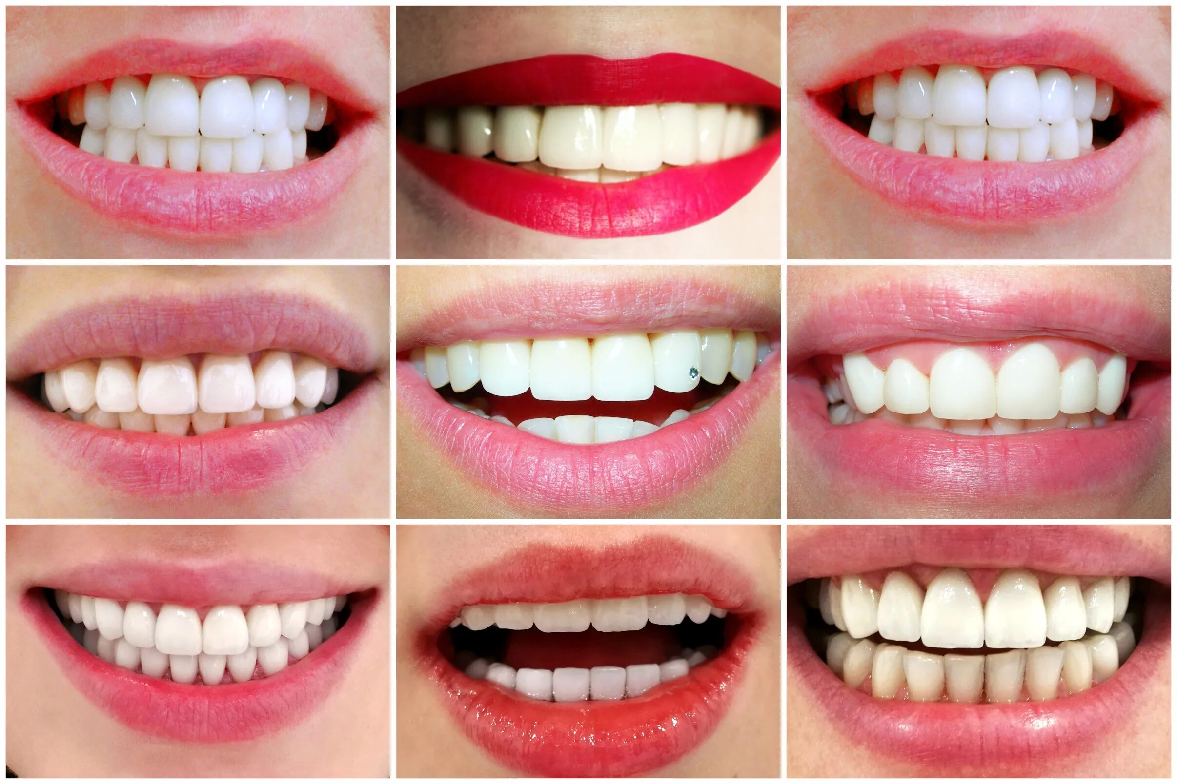 Какая помада делает зубы белее. Помада с желтыми зубами. Цвет помады для белизны зубов. Помада которая отбеливает зубы. Какая помада делает зубы белее.