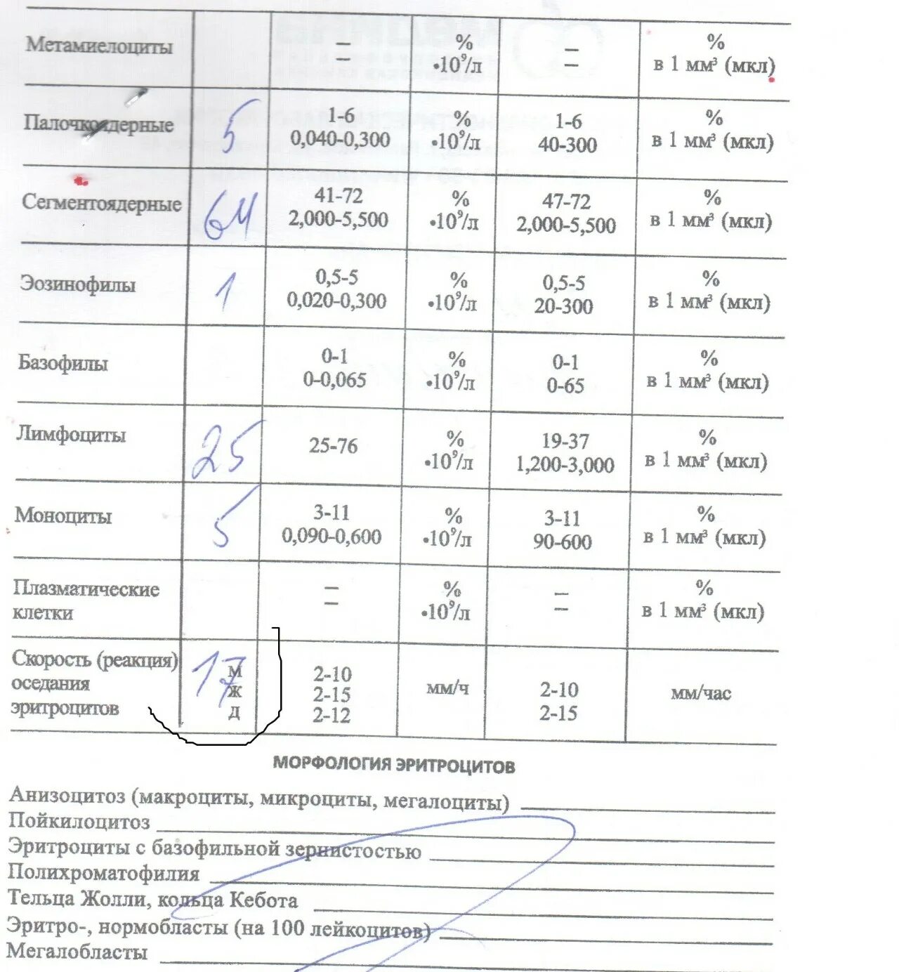 Rdw в анализе крови. RDW-CV В анализе крови что это такое. RDW 11,5.